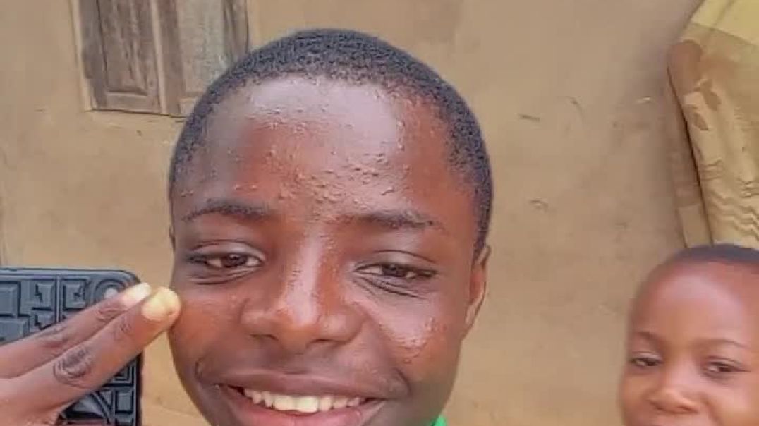 Amebo run into the camera